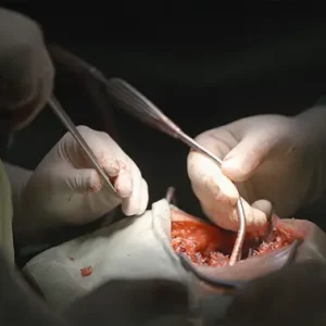 نمای کلوزآپ از عمل جراحی