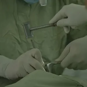 جراح ارتوپد درحال عمل جراحی